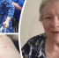 Пенсионерка Татьяна покрылась сыпью и исхудала за месяц в другом пансионате - Газета Бийский рабочий