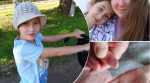 Девочка из Новосибирска родилась с кожей «бабочки»
